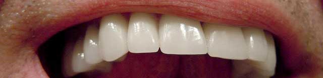 boca-pronunciacion-dest